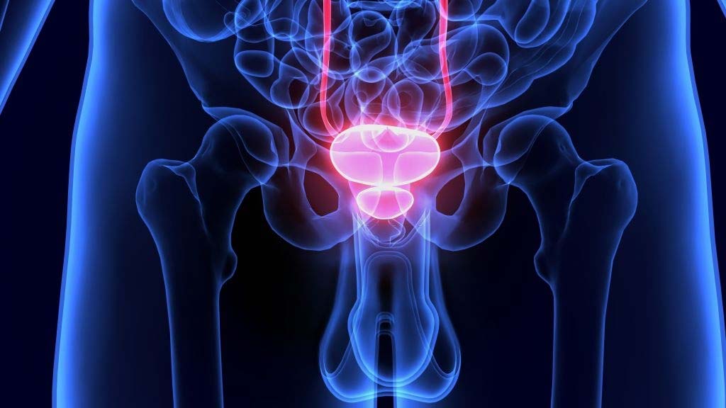 Prostatis ami vezet prosztata termoterápiás kezelés